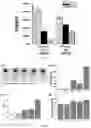 Fig. 02 - NANOCAPSULES COATED WITH CHITOSAN AND USE THEREOF