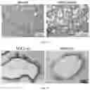 Fig. 02 - Agents for reversing toxic proteinopathies
