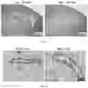 Fig. 03 - Agents for reversing toxic proteinopathies