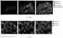 Fig. 05 - Agents for reversing toxic proteinopathies