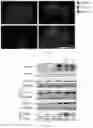 Fig. 08 - Agents for reversing toxic proteinopathies