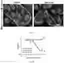 Fig. 13 - Agents for reversing toxic proteinopathies