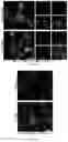 Fig. 29 - Agents for reversing toxic proteinopathies