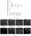 Fig. 52 - Agents for reversing toxic proteinopathies