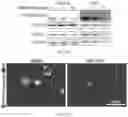 Fig. 60 - Agents for reversing toxic proteinopathies