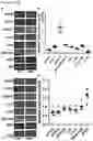 Fig. 03 - METHODS OF TREATING RIGHT VENTRICULAR FUNCTION IN PULMONARY HYPERTENSION