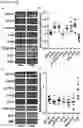 Fig. 04 - METHODS OF TREATING RIGHT VENTRICULAR FUNCTION IN PULMONARY HYPERTENSION