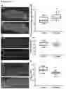 Fig. 05 - METHODS OF TREATING RIGHT VENTRICULAR FUNCTION IN PULMONARY HYPERTENSION