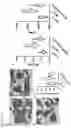 Fig. 09 - METHODS OF TREATING RIGHT VENTRICULAR FUNCTION IN PULMONARY HYPERTENSION