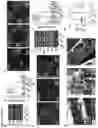 Fig. 14 - METHODS OF TREATING RIGHT VENTRICULAR FUNCTION IN PULMONARY HYPERTENSION