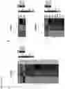 Fig. 17 - METHODS OF TREATING RIGHT VENTRICULAR FUNCTION IN PULMONARY HYPERTENSION