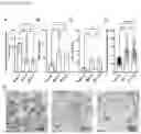 Fig. 27 - METHODS OF TREATING RIGHT VENTRICULAR FUNCTION IN PULMONARY HYPERTENSION