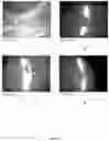 Fig. 08 - Methods for the use of 5′-adenosine diphosphate ribose (ADPR)