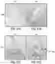 Fig. 65 - Compounds,compositions, and methods for the treatment of disease