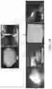 Fig. 05 - Hemostatic agent and method of production thereof