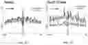 Fig. 26 - CHIMERIC ANTIGEN RECEPTOR T CELLS AND METHODS OF USE THEREOF