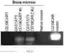 Fig. 45 - CHIMERIC ANTIGEN RECEPTOR T CELLS AND METHODS OF USE THEREOF