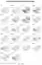 Fig. 96 - CHIMERIC ANTIGEN RECEPTOR T CELLS AND METHODS OF USE THEREOF