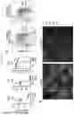 Fig. 02 - METHOD OF TREATING AUTOIMMUNE AND INFLAMMATORY DISEASES USING B CELLS