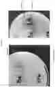 Fig. 04 - COMPOSITIONS COMPRISING BACTERIAL STRAINS