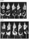 Fig. 23 - DOSING REGIME AND FORMULATIONS FOR TYPE B ADENOVIRUSES