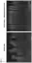 Fig. 06 - METHODS OF TREATING OF INFLAMMATORY BOWEL DISEASE AND PARASITE INFECTION