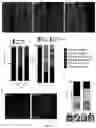 Fig. 07 - EXPRESSION VECTOR FOR CHOLESTEROL 24-HYDROLASE IN THERAPY OF AMYOTROPHIC LATERAL SCLEROSIS