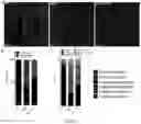 Fig. 12 - EXPRESSION VECTOR FOR CHOLESTEROL 24-HYDROLASE IN THERAPY OF AMYOTROPHIC LATERAL SCLEROSIS