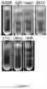 Fig. 06 - METHOD OF PURIFYING VIRUS-LIKE PARTICLES