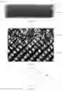 Fig. 02 - BIO-COATING AND IMPLANT