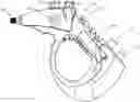 Fig. 01 - Powered Lavage Handle and Associated Use Therefore