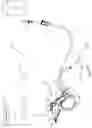 Fig. 02 - Powered Lavage Handle and Associated Use Therefore