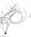 Fig. 07 - Powered Lavage Handle and Associated Use Therefore