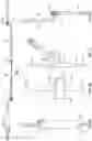 Fig. 02 - ANTI-SNAGGING INFUSION SETS