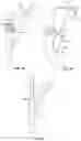 Fig. 04 - ANTI-SNAGGING INFUSION SETS