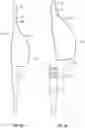 Fig. 08 - ANTI-SNAGGING INFUSION SETS