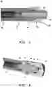 Fig. 04 - Shuttle nib for control of stopper during injection