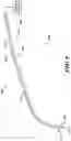 Fig. 12 - VARIABLE PITCH FLEXIBLE NEEDLE