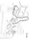 Fig. 02 - Oro-nasal patient interface