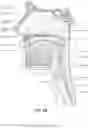 Fig. 06 - Oro-nasal patient interface