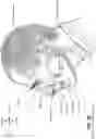 Fig. 08 - Oro-nasal patient interface