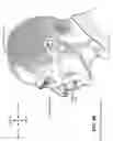Fig. 09 - Oro-nasal patient interface