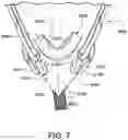 Fig. 22 - Oro-nasal patient interface