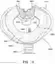 Fig. 28 - Oro-nasal patient interface