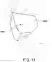 Fig. 32 - Oro-nasal patient interface
