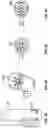 Fig. 05 - Ear mounted cannular nasal breathing filter