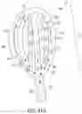 Fig. 63 - Percutaneous urinary catheter