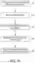Fig. 77 - Percutaneous urinary catheter