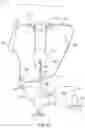 Fig. 83 - Percutaneous urinary catheter