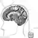 Fig. 01 - Adaptive deep brain stimulation of the superolateral medial forebrain bundle